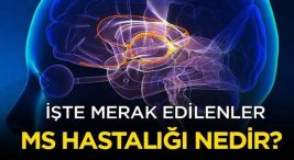 MS Hastalığı (Multipl Skleroz) Nedir?