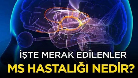 MS Hastalığı (Multipl Skleroz) Nedir?