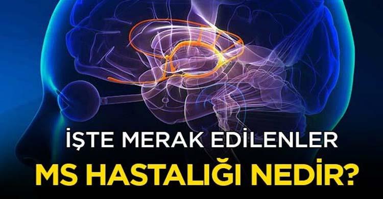 MS Hastalığı (Multipl Skleroz) Nedir?